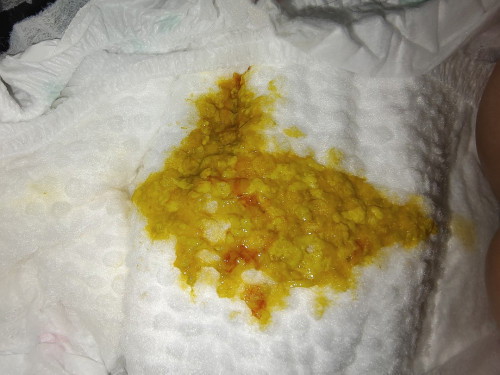 Najis anak bewarna kuning campir merah
