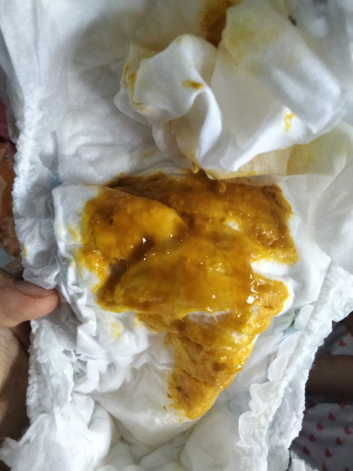 Fases lendir pada bayi