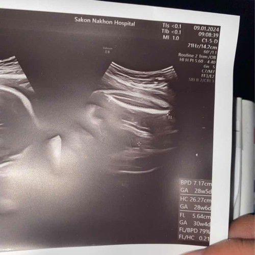 แม่ๆช่วยดูเพศน้องทีค่ะ