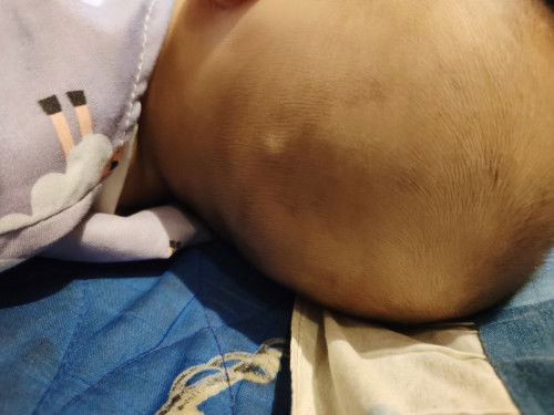 Benjolan di belakang kepala