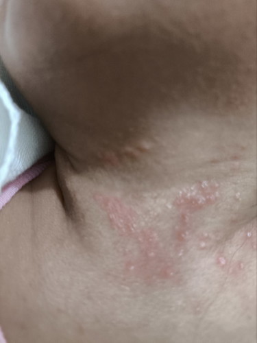 Neck 1 month old baby