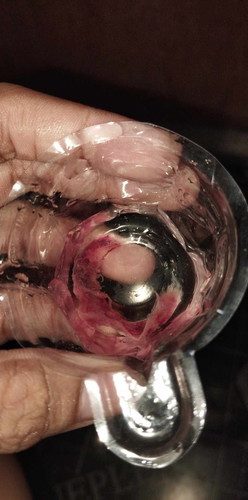 Sorry for sensitive photo