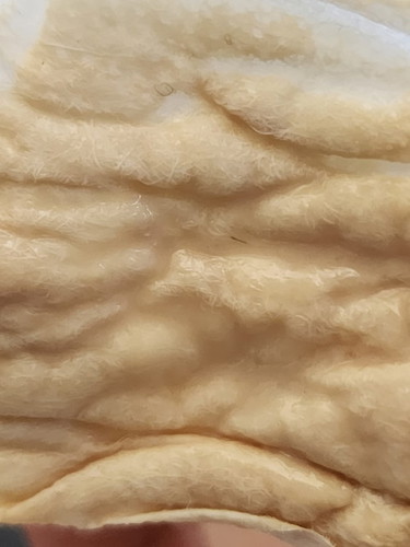 Vaginal Discharge