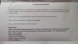 34 weeks and 3 days sa ultrasound, pero 33weeks lang base sa LMP