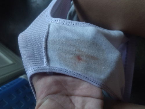 Ano po kaya tong nalabas na spotting sa pwerta ko?