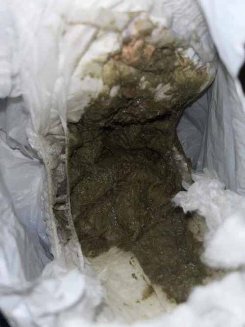 Ini BAB normal ga ya bun