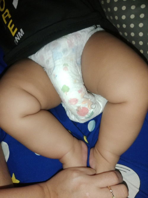 Kaki bayi punya lipatan sebelah