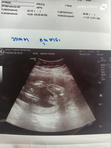 ภาพอัลตร้าซาวด์