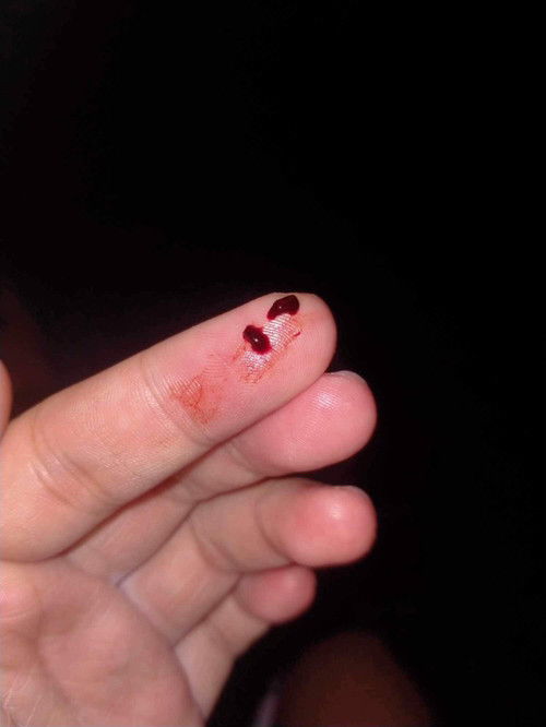 แม่ๆคนไหนมีประสบการณ์เลือดออกตอน 30 w มั้ยคะ