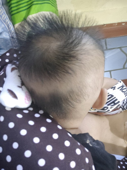 Rambut bayi jarang2