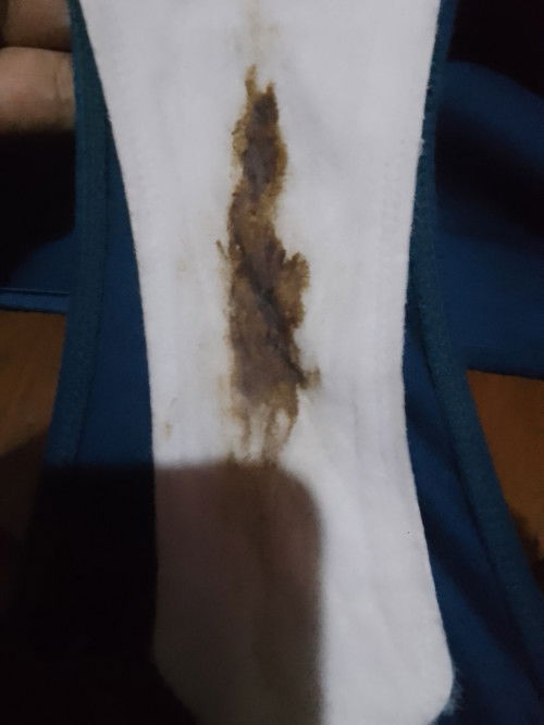 Malapit na ba ako manganak pag ganito??