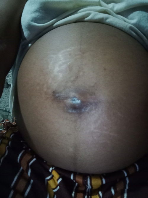 Pinggang sakit dan perut bagian bawah nyeri