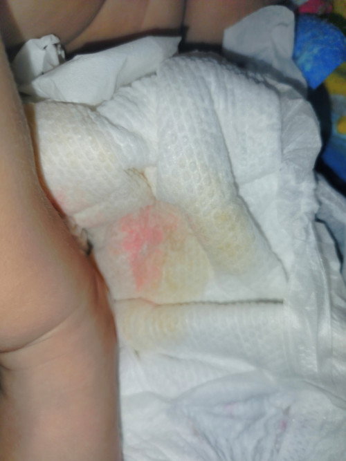 Pampers bayi warna orange bercampur dengan pipis