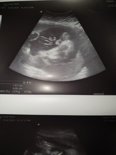 29+4week 💓