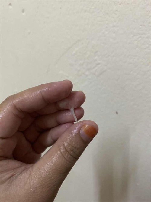 Keluar sikit , tapi ni apa ?