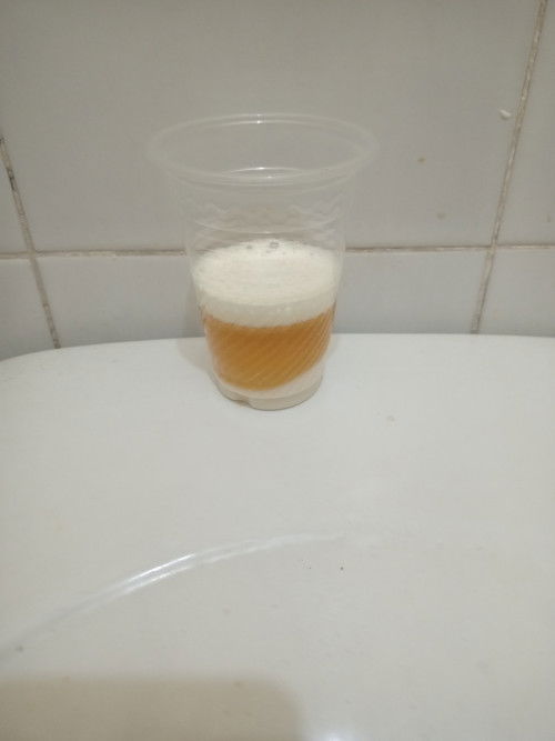 Gender Test baking soda and urine