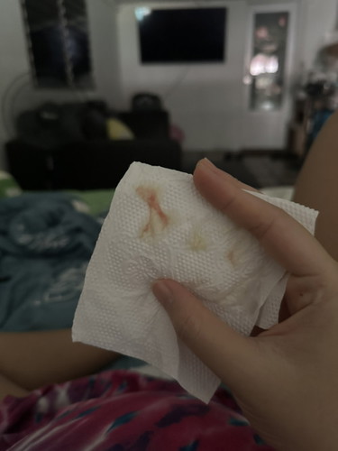 แม่ๆ 36 วีค มีใครเป็นแบบนี้บ้างคะ