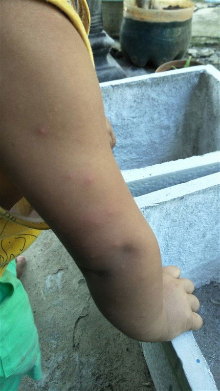 Obatnya apa ya bund?