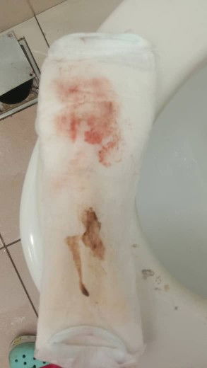 kalau dah turun tanda n leaking berapa lama jangka bersalin ea ..