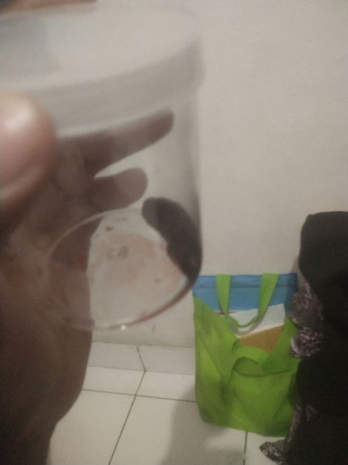 moms mau nanya aku hamil 6 week trs keluar darah ncrit2 gitu trs pas aku ke rs keluar kaya gitu