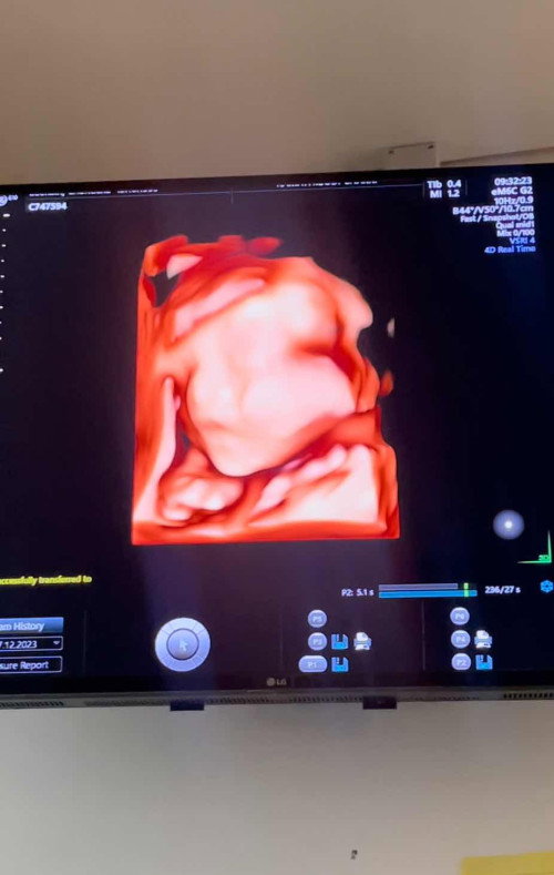 28 wk . แล้ว นน. น้องของคุณแม่เท่าไหร่กันแล้วคะ