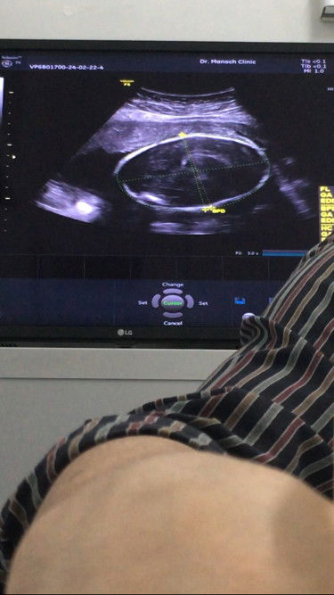 หัวผิดปกติ ตอน 30w