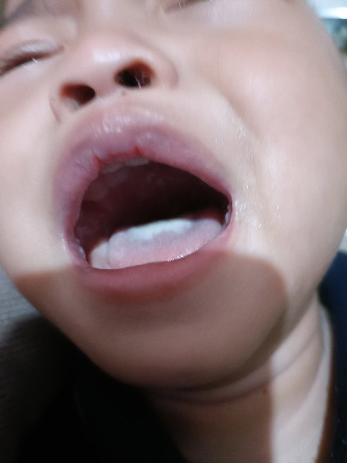 Putih putih di mulut bayi