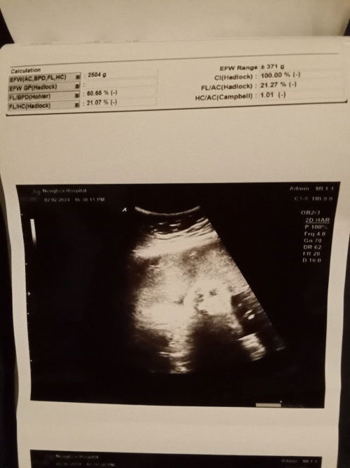 สอบถามหน่อยคะ มาแชร์ประสบการณ์กันคะ