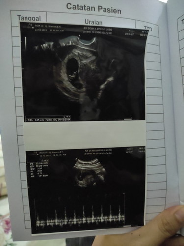 USG transvaginal 7week