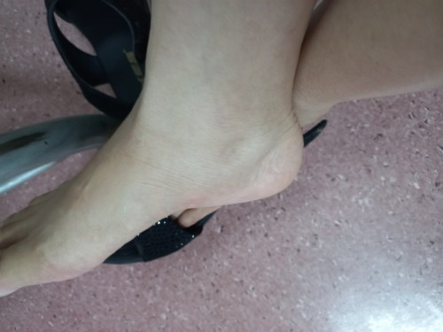 Kaki sembap 16 weeks