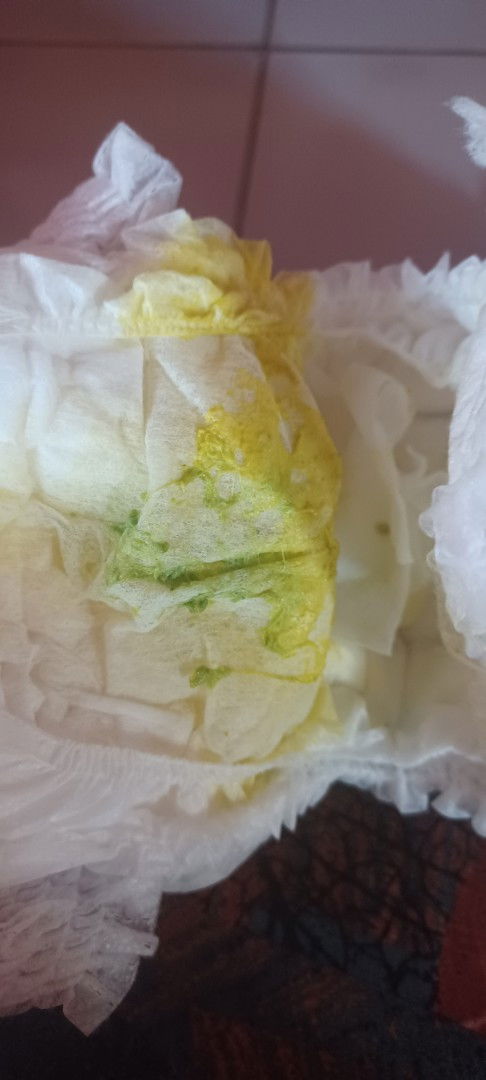 Bayi 5 bulan 24 hari pup warna hijau