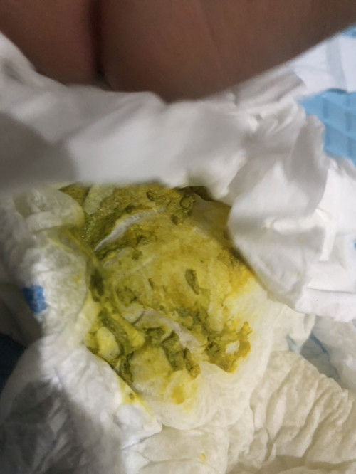 Warna pup bayi yang aman