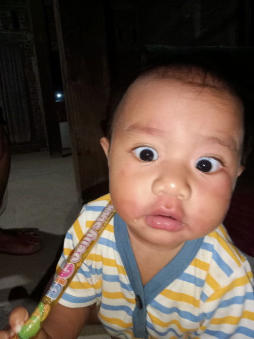 Muka merah seperti alergi