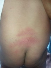 Ini knpa yh bun di bayi saya usia 5 bulan