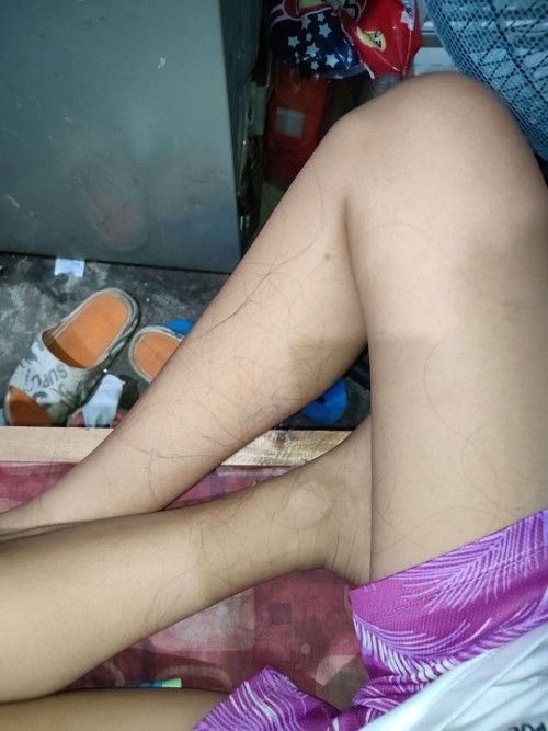 Ask ko lang po sana kung hanggang kailan po ang postpartum hairloss?