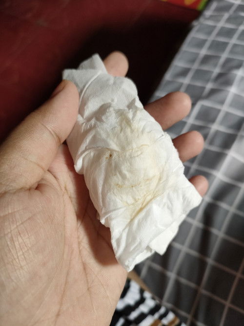 Keluar kuning sedikit coklat