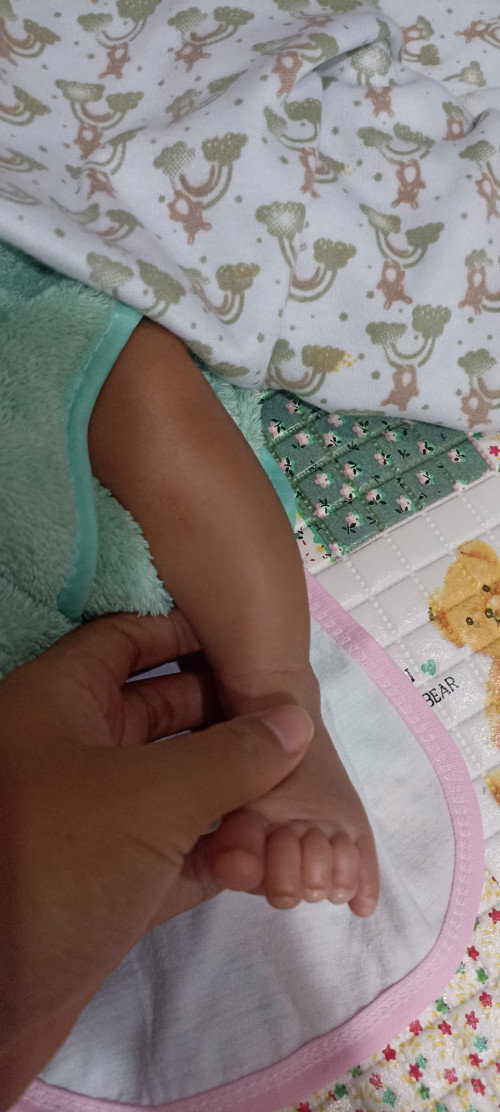 Hallo bunda 
Tulang betis bayi terlihat bengkok