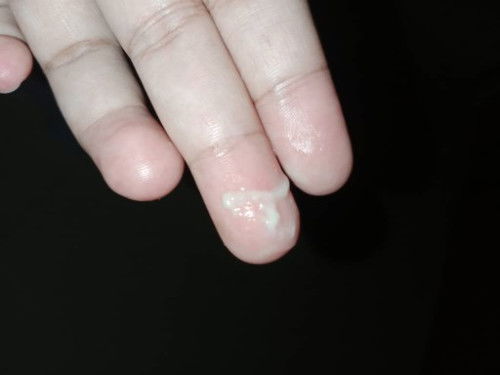 Keputihan atau tanda?