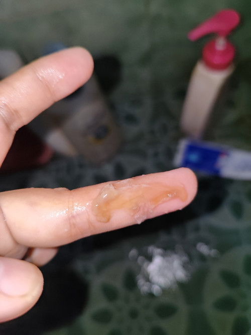 keputihan berwarna kecoklatan