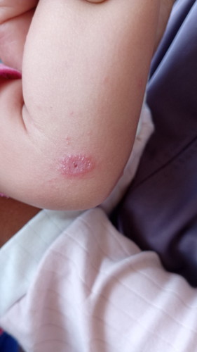 Kulit bayi ada seperti ini