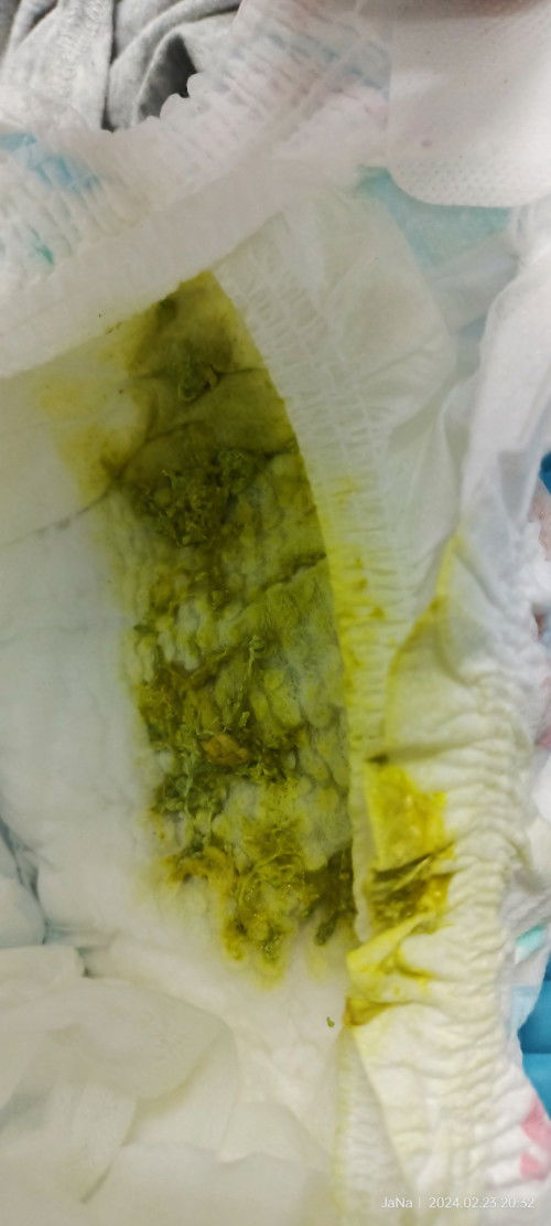 Maaf 
(Warna najis bayi)