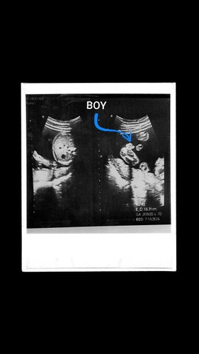 FINALLY A BABY BOY!!🩵 FOUND OUT AT 20 WEEKS🫶🏻