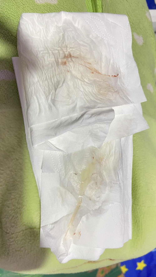 ควรไปหาหมอไหมค่ะ