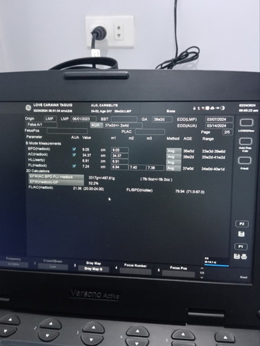 Ilang kilo na po kaya ito?  Nakalimutan ko po kase itanong 2-3cm narin po ako gano po katagal bago m