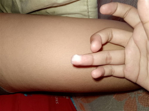 สอบถามค่ะ35+3