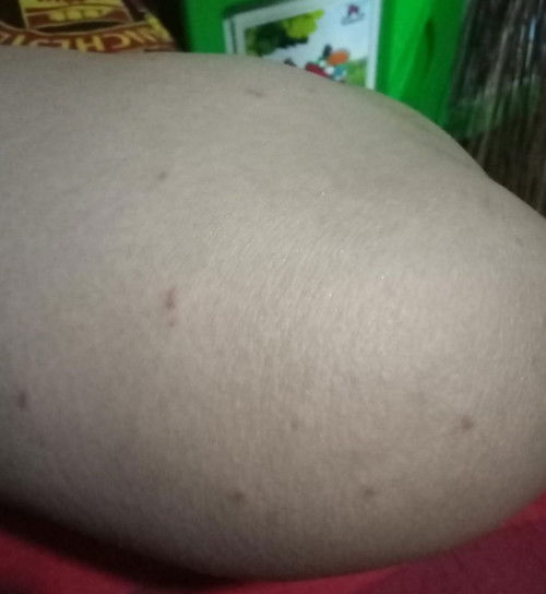 Assalamu alaikum Ada yg sama gak bund UK 34 minggu tapi kok malah bintik merah kek gini