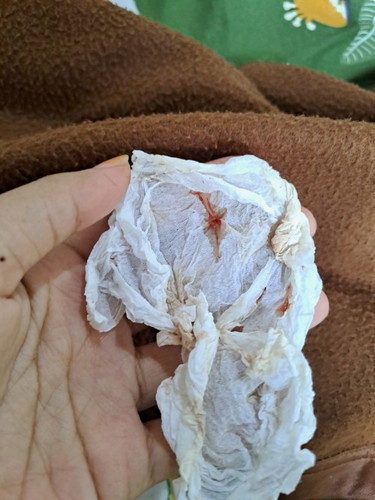 Kenapa ya bun keluar lendir bercampur darah disertai kram perut, apakah tanda kehamilan?