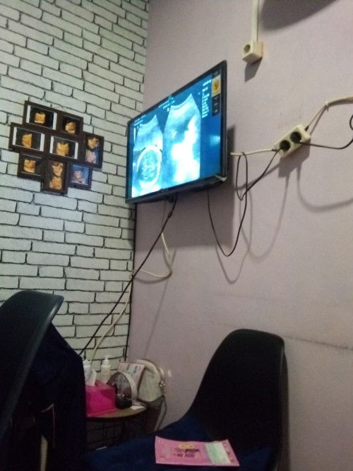 apakah bayi sungsang bisa normal kembali ? apakah bund ada yang sungsang? mohon jawab ya bund 🙏