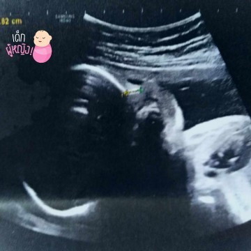 ได้ลูกสาวสมใจเลยค่ะแม่ๆ😊😍