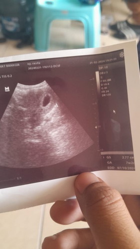 Hamil 7minggu tp mens di minggu ke 3
